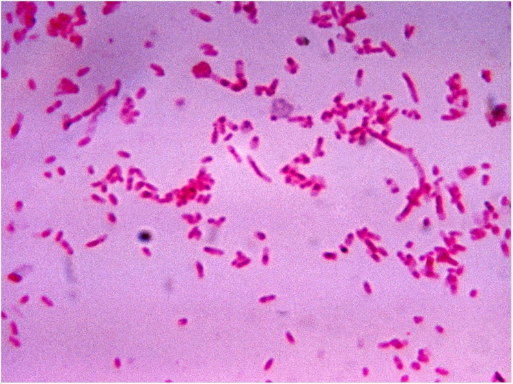 Childrens Dental Care Delray Fusobacterium novum after being cultured in a thioglycollate medium.