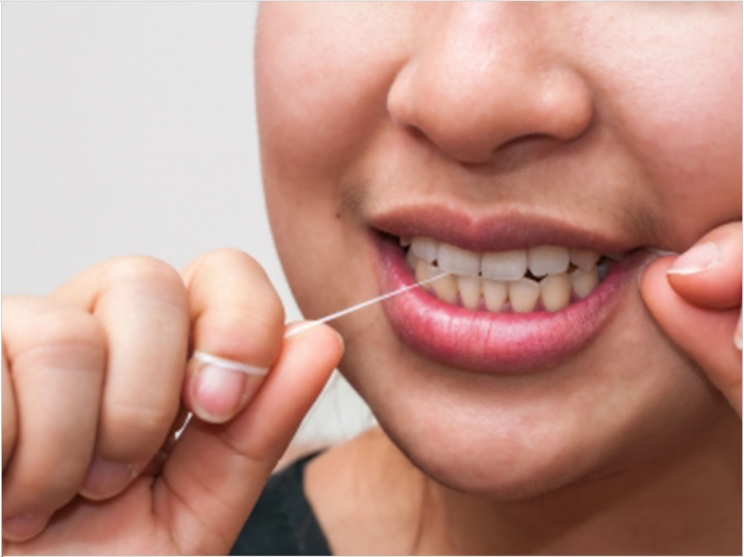 Childrens Dental Care Delray Professional Groups Defend Flossing’s Effectiveness
